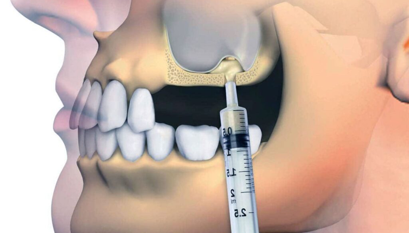 Odontoiatria conservativa